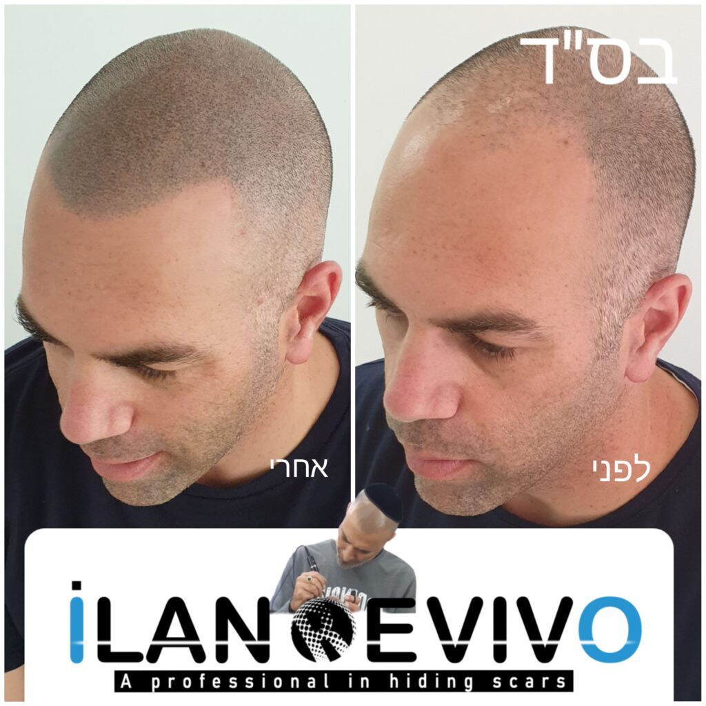 הדמיית שיער